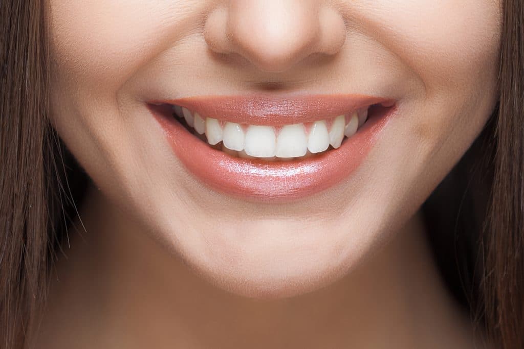 2 Options For Whitening Your Teeth Blog 1024x683