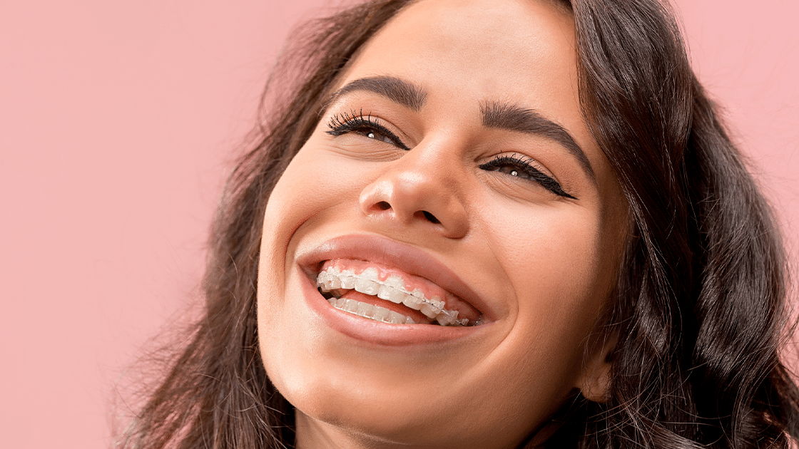 woman with clear braces